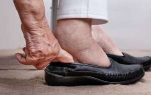 Evitare la ritenzione idrica: consigli per combatterla