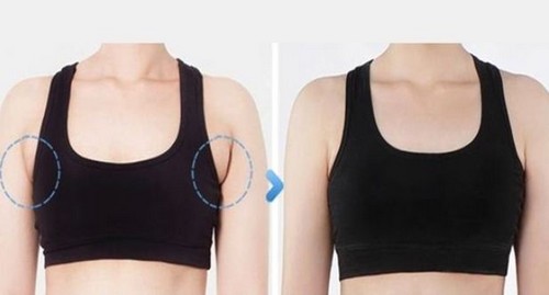 esempio di grasso sotto le ascelle