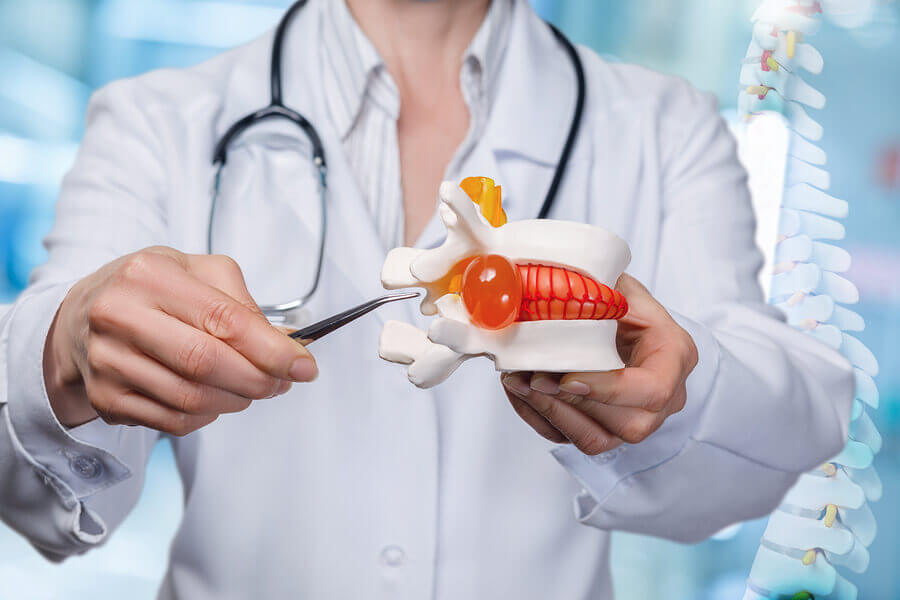 Dottore che spiega cosa è una ernia del disco