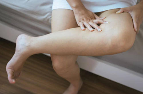 Gambe gonfie: cosa le causa?