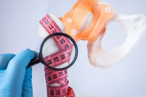 Metro per misurare la densità ossea.