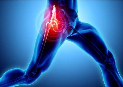 Illustrazione di una lesione al fianco.